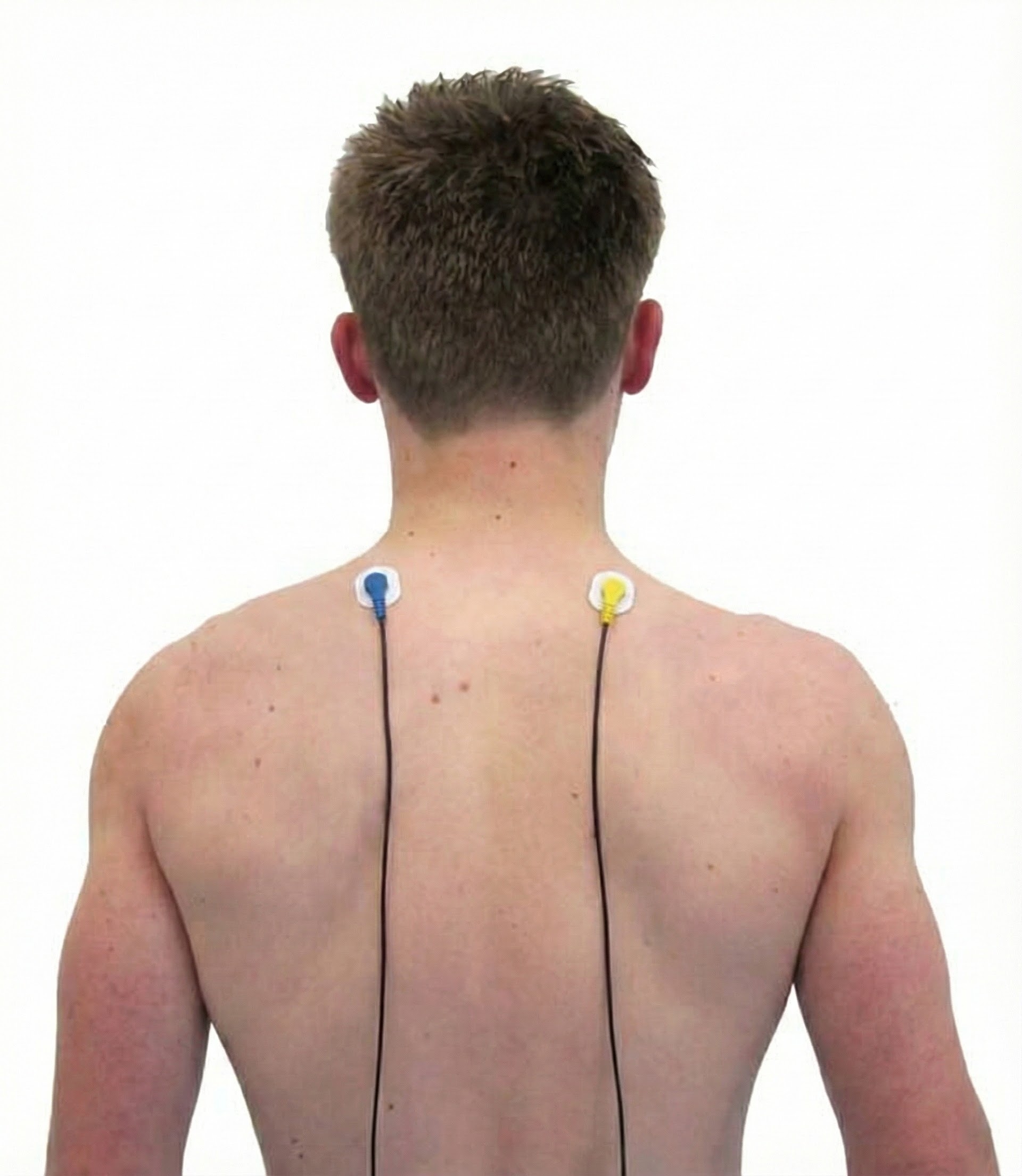 Bilateral upper trapezius narrow bandpass
